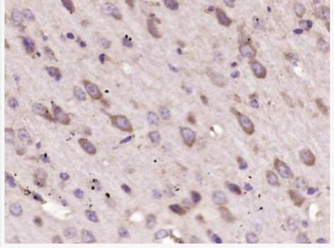 Anti-FGF5  antibody-纤维母细胞生长因子5抗体