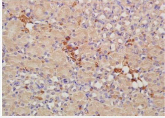 Anti-CRIM1 antibody-富含半胱氨酸运动神经元蛋白1抗体