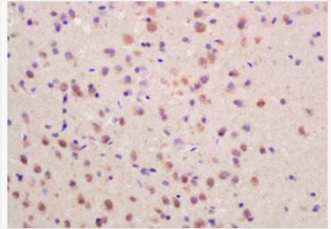 Anti-SOCS3 antibody-细胞因子信号传导抑制蛋白3抗体