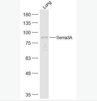 Anti-Sema3A  antibody-臂板蛋白3A抗体