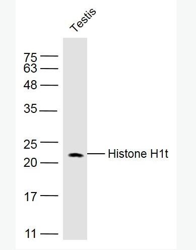 Anti-Histone H1t antibody-组蛋白H1抗体