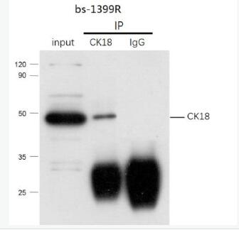 Anti-E2F4 antibody-转录因子E2F-4抗体