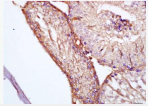 Anti-Clusterin antibody-载脂蛋白J（APOJ）抗体