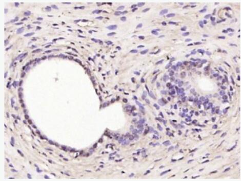 Anti-RSL1D1  antibody-细胞衰老抑制基因抗体