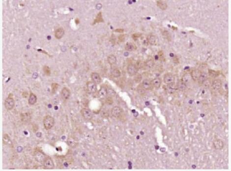 Anti-factor V antibody-凝血因子5抗体