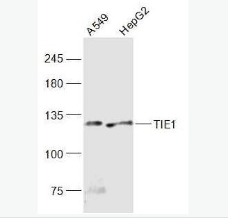 Anti-TIE1  antibody-血管生成素受体1抗体