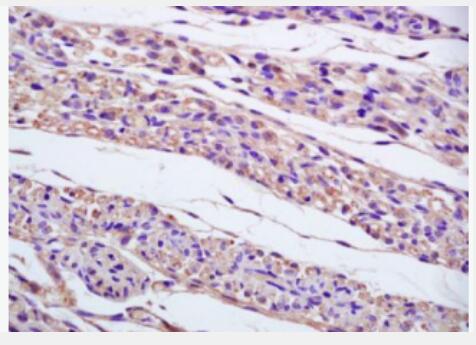 Anti-gamma tubulin antibody-基微管蛋白γ/Tubulin γ抗体