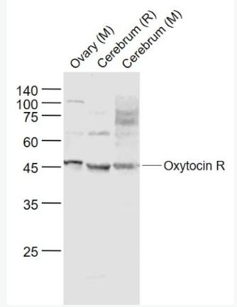 Anti-Oxytocin R  antibody-催产素受体(缩宫素受体)抗体