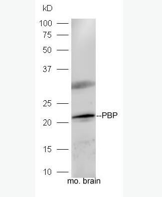 Anti-PBP antibody-磷脂酰乙醇胺结合蛋白1抗体