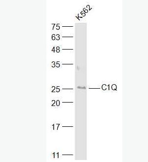 Anti-C1QA antibody-补体C1qα链多肽抗体