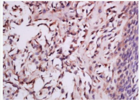 Anti-MSRB2 antibody-蛋氨酸亚砜还原酶B2抗体