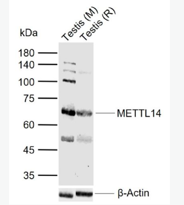 Anti-METTL14 antibody-甲基转移酶样蛋白14抗体