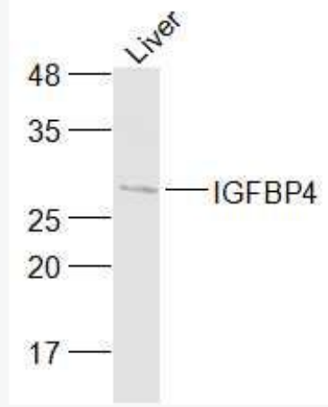 Anti-IGFBP4  antibody-胰岛素样生长因子结合蛋白4抗体