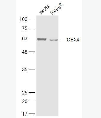 Anti-CBX4 antibody-染色盒同源物4抗体