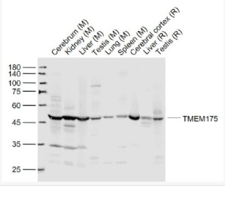 Anti-TMEM175 antibody-跨膜蛋白175抗体