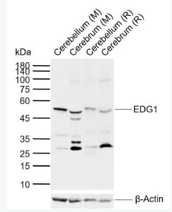 Anti-EDG1  antibody-内皮细胞分化鞘脂G蛋白偶联受体1抗体