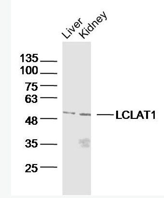 Anti-LCLAT1 antibody-心磷脂酰基转移酶1抗体