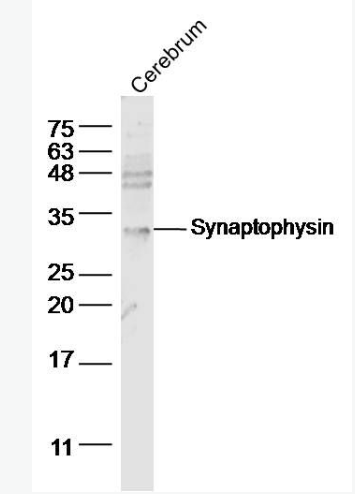 Anti-Synaptophysin  antibody-突触小泡蛋白P38抗体