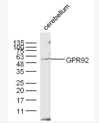 Anti-GPR92 antibody-G蛋白偶联受体GPR92蛋白抗体