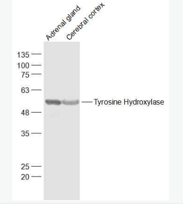 Anti-Tyrosine Hydroxylase  antibody