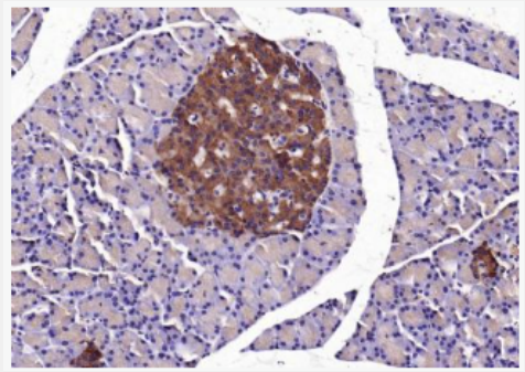 Anti-SLC26A6 antibody-溶质载体家族蛋白26成员6抗体