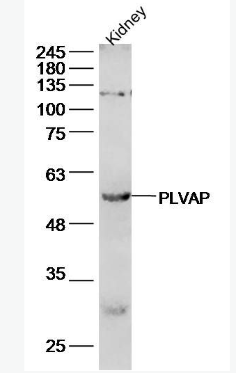 Anti-PLVAP  antibody-质膜囊泡相关蛋白抗体