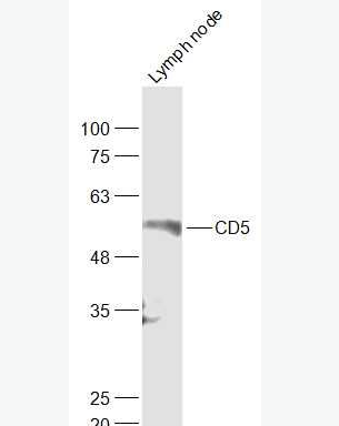 Anti-CD5  antibody-CD5抗体