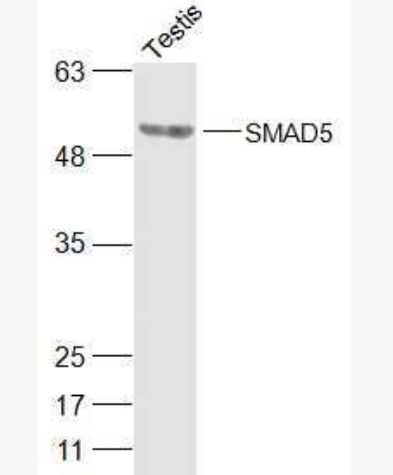 Anti-SMAD5 antibody-细胞信号转导分子SMAD5抗体