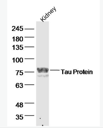 Anti-Tau antibody-微管相关蛋白抗体.