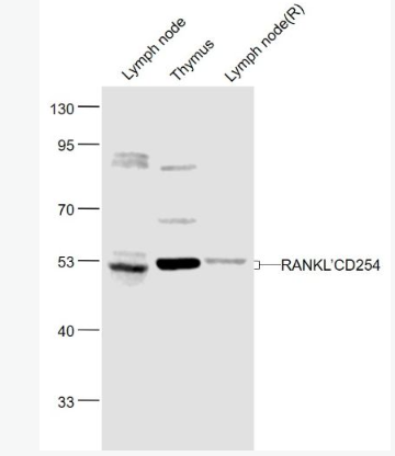 Anti-RANKL/CD254 antibody-骨保护蛋白配体/破骨细胞分化因子抗体.