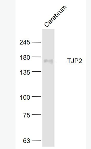 Anti-TJP2  antibody-紧密连接蛋白2抗体