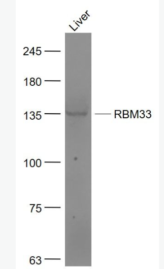 Anti-RBM33  antibody-RNA结合蛋白33抗体