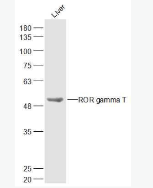 Anti-ROR gamma T antibody-C维甲酸相关孤儿受体γt抗体