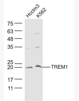 Anti-DCTREM1antibody-髓系细胞触发受体1抗体