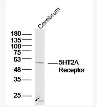Anti-5HT2A Receptor  antibody-5-羟色胺受体2A抗体