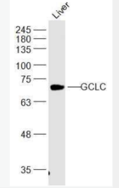 Anti-GCLC  antibody-γ谷氨酰半胱氨酸合成酶抗体