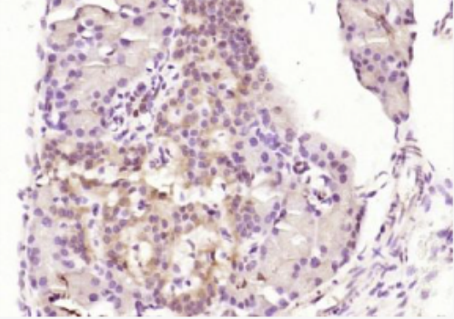 Anti-Karyopherin beta 3  antibody-核转运蛋白β3抗体