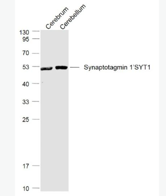 Anti-Synaptotagmin 1/SYT1 antibody-突触结合蛋白1抗体