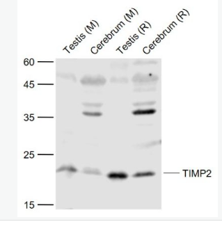 Anti-TIMP-2 antibody-金属蛋白酶组织抑制因子-2抗体