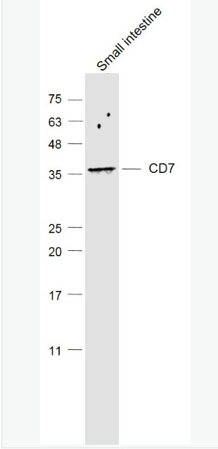 Anti-CD7 antibody-CD7抗体