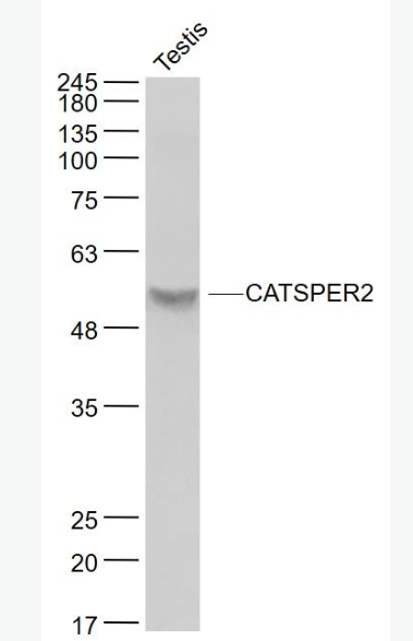 Anti-CATSPER2 antibody-阳离子通道精子相关蛋白2抗体