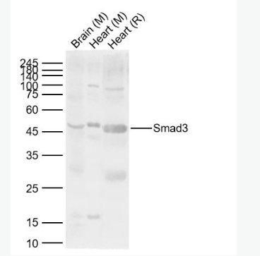 Anti-Smad3 antibody-细胞信号转导分子SMAD3抗体
