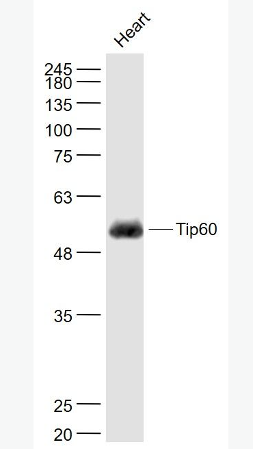Anti-KAT5 / Tip60 antibody-TIP60抗体