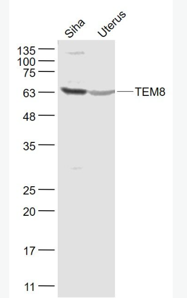 Anti-TEM8  antibody-肿瘤血管内皮标志物8抗体