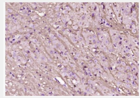 Anti-LINGO1 antibody-Nogo受体反应蛋白抗体