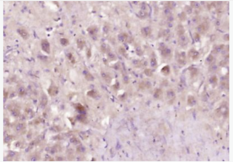 Anti-SERPINC1 antibody-抗凝血酶3抗体