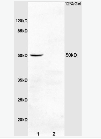 Anti-PDCD4  antibody-凋亡相关蛋白4抗体