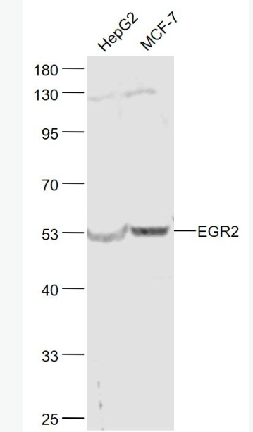 Anti-EGR2 antibody-早期生长反应蛋白2抗体