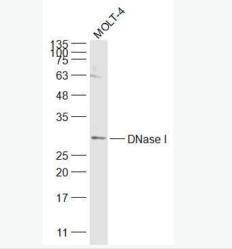 Anti-DNase I antibody-脱氧核糖核酸酶1抗体