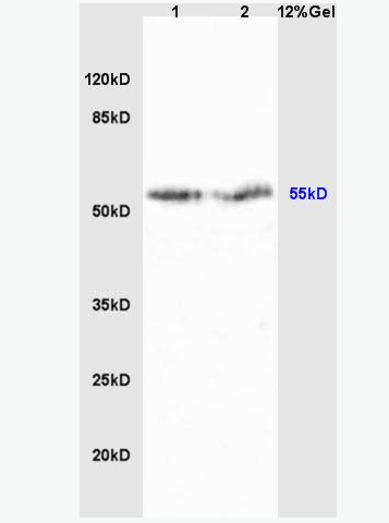 Anti-Cyp2J3 antibody-细胞色素P450Ⅱj3抗体